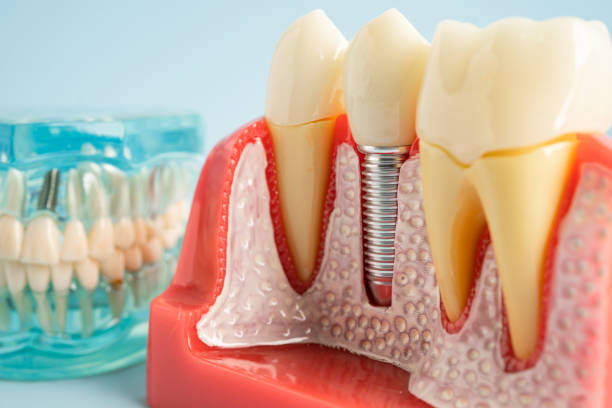 Professional Dental Services in Oro Valley, AZ